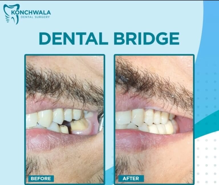 DentistInKarachi | RootCanalInKarachi | DentistNearMeInKarachi | DentalImplantsInKarachi | TeethWhiteningInKarachi | OrthodontistInKarachi | DentalClinicNearMeInKarachi | VeneersInKarachi | WisdomTeethRemovalInKarachi | BestDentistNearMeInKarachi | TeethAlignersInKarachi | ToothExtractionInKarachi | ToothacheInKarachi | DentalHygienistInKarachi | DentalSpecialistInKarachi | FamilyDentistInKarachi